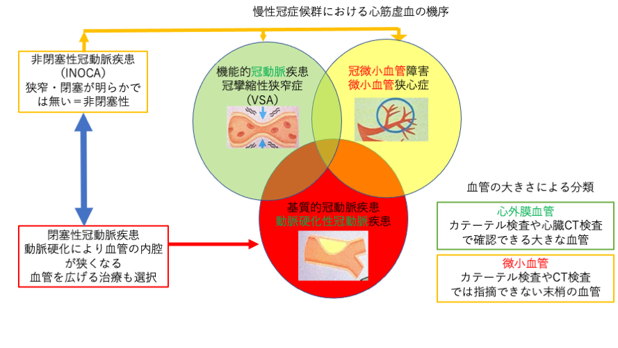 冠動脈疾患・虚血性心疾患（狭心症、心筋梗塞）の診断・治療 | いとう内科クリニック